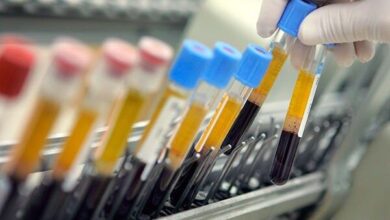 ۵ دوپینگی جدید در ورزش ایران 6 | نقش نیوز ۵ دوپینگی جدید در ورزش ایران