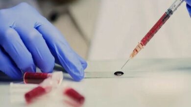 کافئین ، نیکوتین و کدئین دوپینگ حساب میشوند؟ 6 | نقش نیوز کافئین ، نیکوتین و کدئین دوپینگ حساب میشوند؟