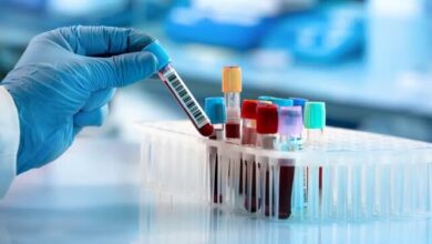 یک آزمایش خون جدید برای تشخیص پارکینسون در مراحله اولیه