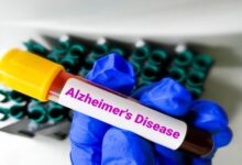 تاثیر پیاده‌روی روزانه بر مهار آلزایمر