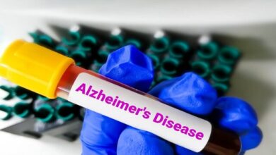 تاثیر پیادهروی روزانه بر مهار آلزایمر 2 | نقش نیوز تاثیر پیادهروی روزانه بر مهار آلزایمر