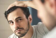 درمانی برای طاسی